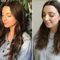 When is the Best Time to Get Botox Before an Event?