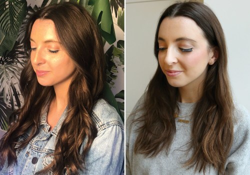 When is the Best Time to Get Botox Before an Event?