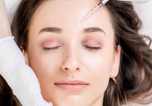 How Long Does Botox Headache Last?