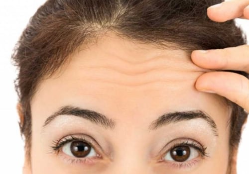 What to Avoid When Receiving Botox Injections